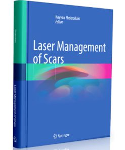 Laser Management of Scars
