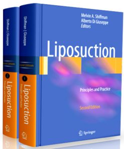 Liposuction: Principles and Practice