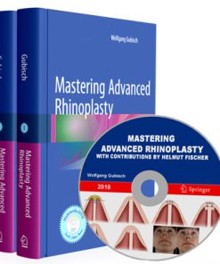 Mastering Advanced Rhinoplasty