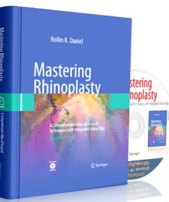 Mastering Rhinoplasty - A Comprehensive Atlas of Surgical Techniques with Integrated Video Clips