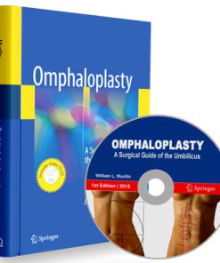 Omphaloplasty: A Surgical Guide of the Umbilicus