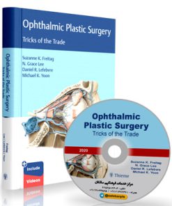 Ophthalmic Plastic Surgery: Tricks of the Trade