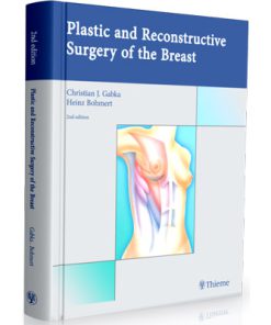 Plastic and Reconstructive Surgery of the Breast: A Surgical Atlas