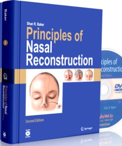 Principles of Nasal Reconstruction
