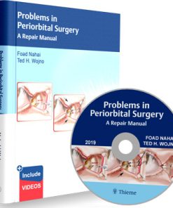 Problems in Periorbital Surgery: A Repair Manual