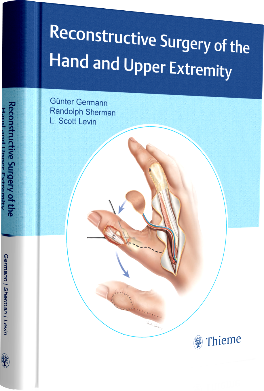 Reconstructive Surgery of the Hand and Upper Extremity انتشارات سالکان