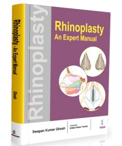 Rhinoplasty—An Expert Manual