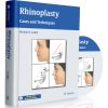 Rhinoplasty: Cases and Techniques