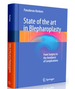 State of the art in Blepharoplasty: From Surgery to the Avoidance of Complications