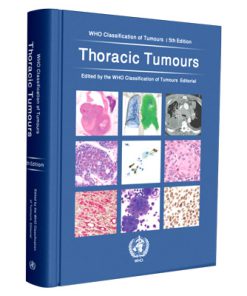 Thoracic Tumours: WHO Classification of Tumours
