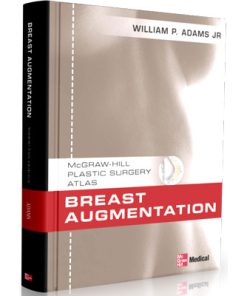 Breast Augmentation: An Operative Atlas