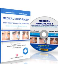MEDICAL RHINOPLASTY Basic principles And Clinical Practice
