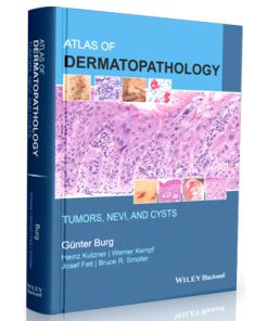 Atlas of Dermatopathology: Tumors, Nevi, and Cysts