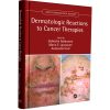 Dermatologic Reactions to Cancer Therapies (Series in Dermatological Treatment)