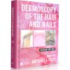Dermoscopy of the Hair and Nails