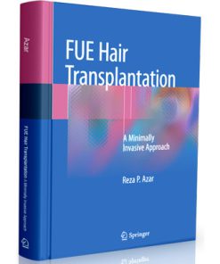 FUE Hair Transplantation: A Minimally Invasive Approach