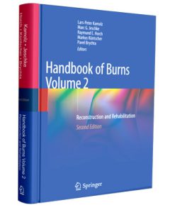 Handbook of Burns Volume 2: Reconstruction and Rehabilitation
