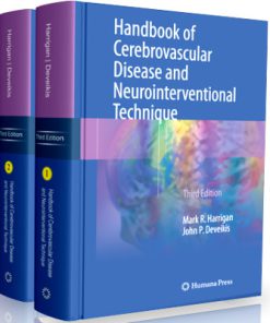 Handbook of Cerebrovascular Disease and Neurointerventional Technique (Contemporary Medical Imaging)