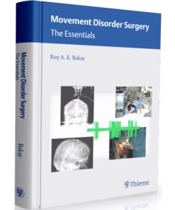 Movement Disorder Surgery: The Essentials