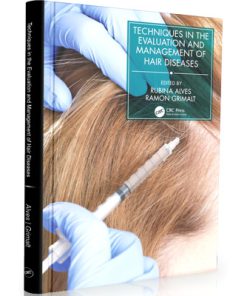 Techniques in the Evaluation and Management of Hair Diseases (Series in Dermatological Treatment)
