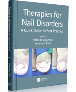 Therapies for Nail Disorders: A Quick Guide to Best Practice