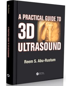 A Practical Guide to 3D Ultrasound