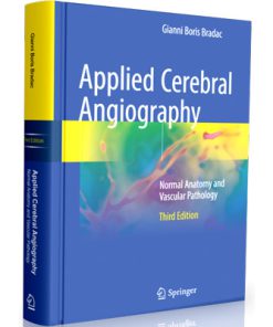 Applied Cerebral Angiography: Normal Anatomy and Vascular Pathology