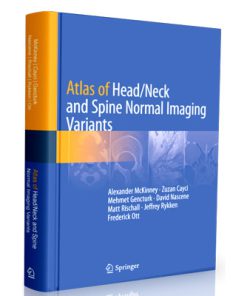 Atlas of Head - Neck and Spine Normal Imaging Variants