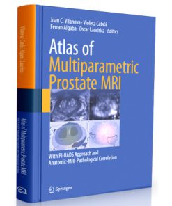 Atlas of Multiparametric Prostate MRI With PI-RADS Approach and Anatomic-MRI-Pathological Correlation