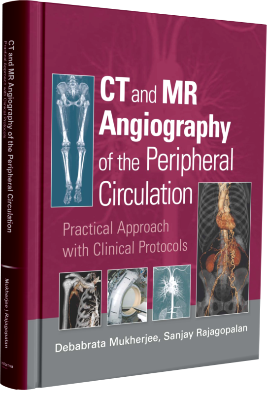 ct peripheral angiography protocol radiopaedia