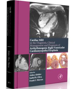Cardiac MRI in Diagnosis, Clinical Management, and Prognosis of Arrhythmogenic Right Ventricular Cardiomyopathy/Dysplasia