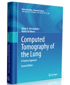 Computed Tomography of the Lung: A Pattern Approach (Medical Radiology)