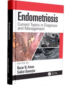 Endometriosis - Current Topics in Diagnosis and Management