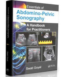Essentials of Abdomino-Pelvic Sonography - A Handbook for Practitioners