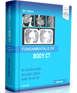 Fundamentals of Radiology Series: Fundamentals of Body CT