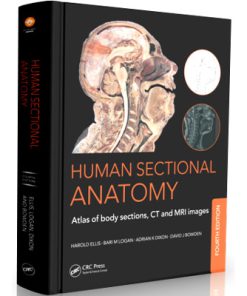 Human Sectional Anatomy: Atlas of Body Sections, CT and MRI Images