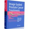 Image Guided Prostate Cancer Treatments