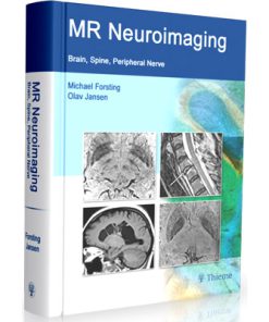 MR Neuroimaging: Brain, Spine, Peripheral Nerves