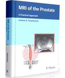 MRI of the Prostate: A Practical Approach