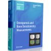 Measurement Books Series in Radiology: Osteoporosis and Bone Densitometry Measurements (Medical Radiology)