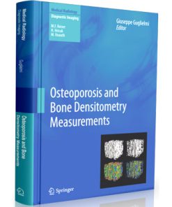 Measurement Books Series in Radiology: Osteoporosis and Bone Densitometry Measurements (Medical Radiology)