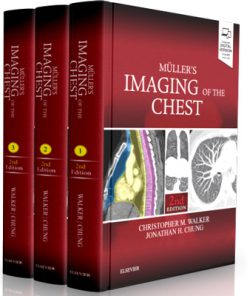 Muller's Imaging of the Chest: Expert Radiology Series