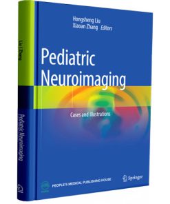 Pediatric Neuroimaging: Cases and Illustrations