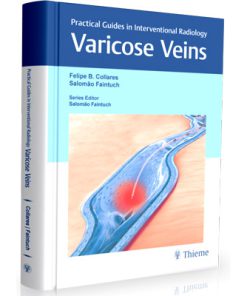 Varicose Veins : Practical Guides in Interventional Radiology