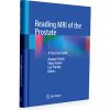 Reading MRI of the Prostate, A Practical Guide