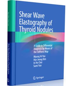 Shear Wave Elastography of Thyroid Nodules: A Guide to Differential Diagnosis by Means of the Stiffness Map