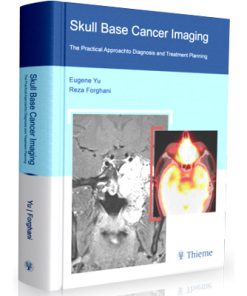 Skull Base Cancer Imaging: The Practical Approach to Diagnosis and Treatment Planning