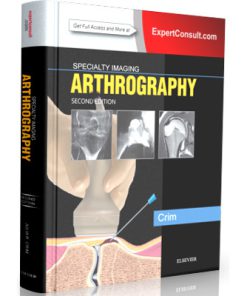 Specialty Imaging: Arthrography