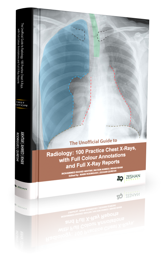 Unofficial Guide to Radiology Chest, Abdominal and Orthopaedic X Rays
