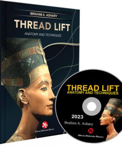 Thread Lift Anatomy and Techniques